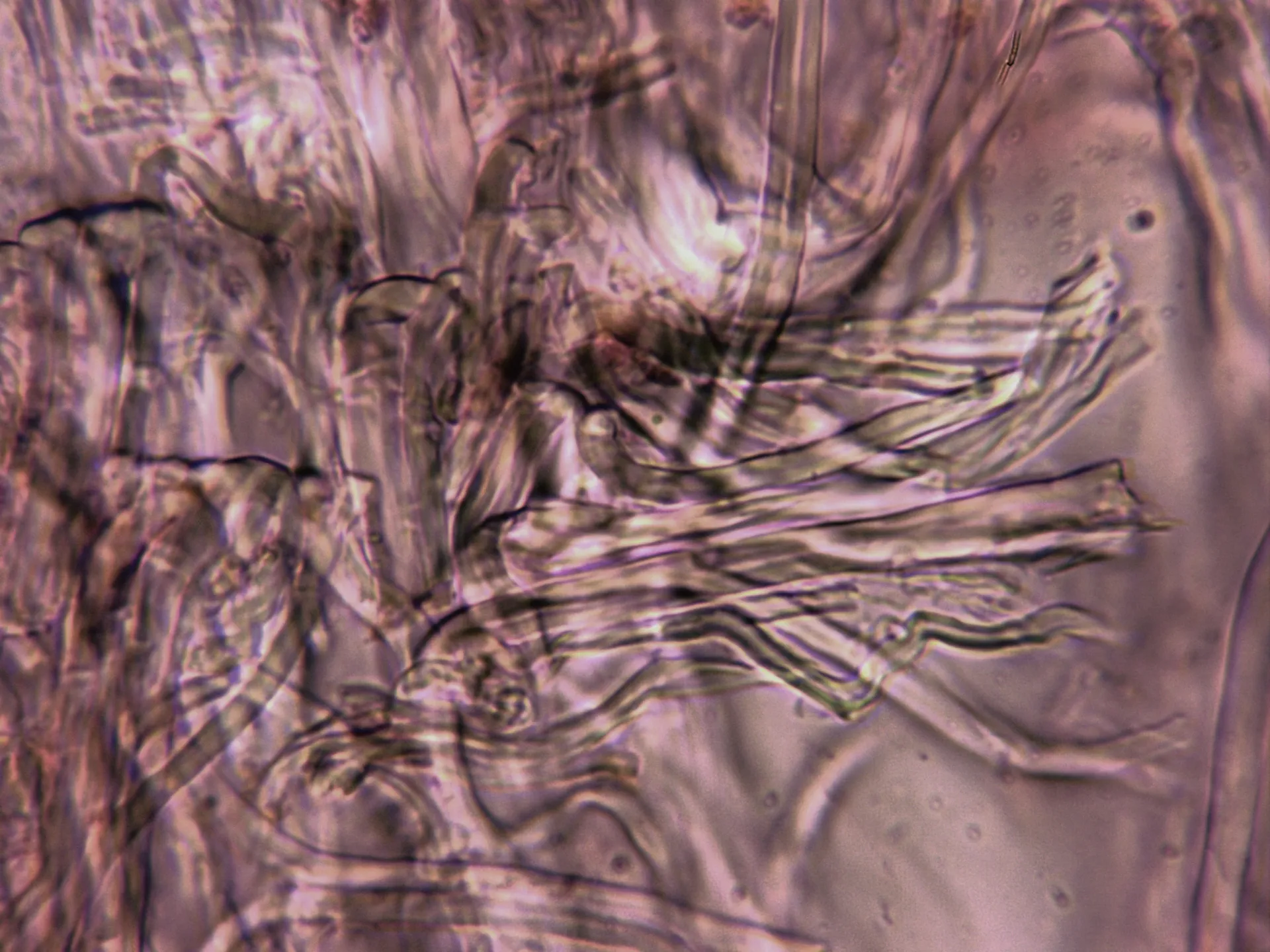 Microscopía de Trichaptum abietinum - 10 - Sistema dimítico